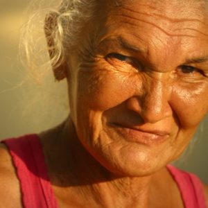 serious eye symptoms