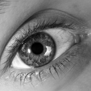 hyphema
