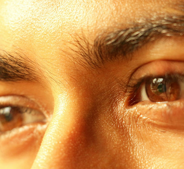 dry eyes
